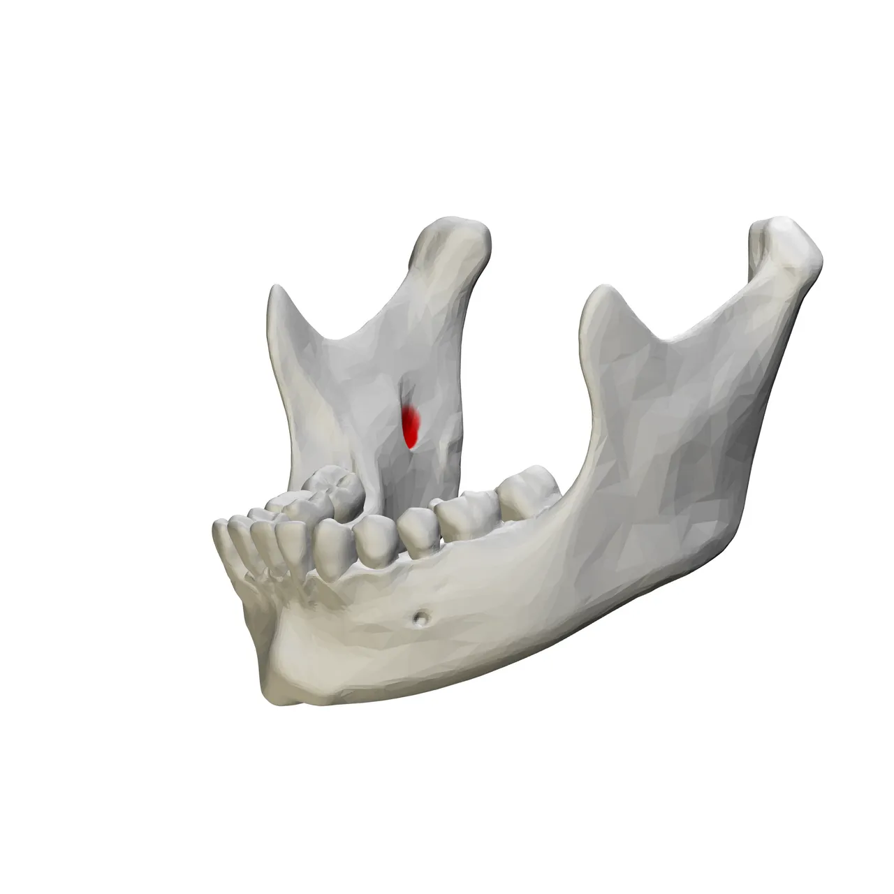 3D model of the mandible with the mandibular foramen on the medial surface of the ramus marked in red
