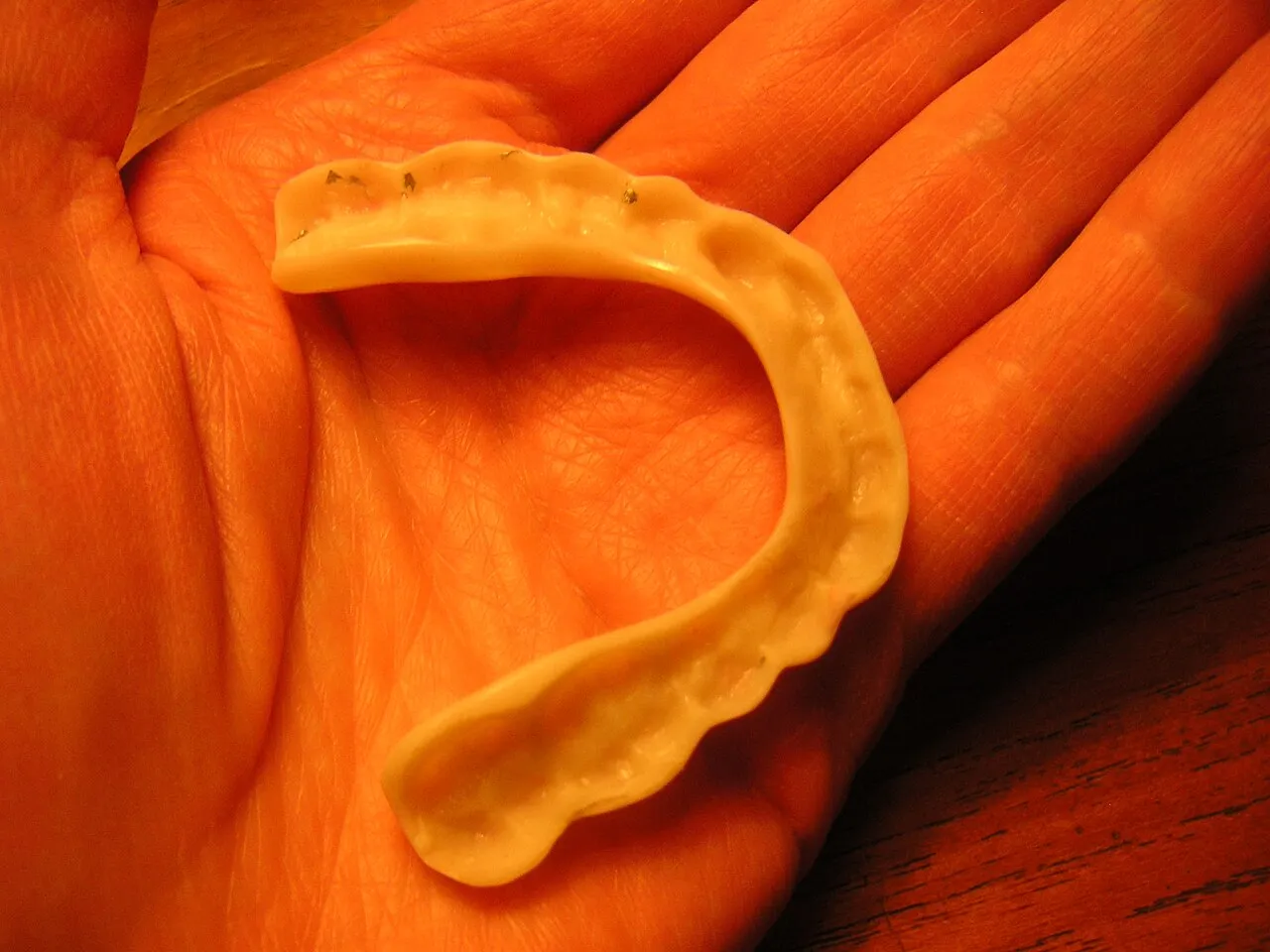 A custom-made mouthguard, formed on a cast of the maxillary arch, held in an open hand