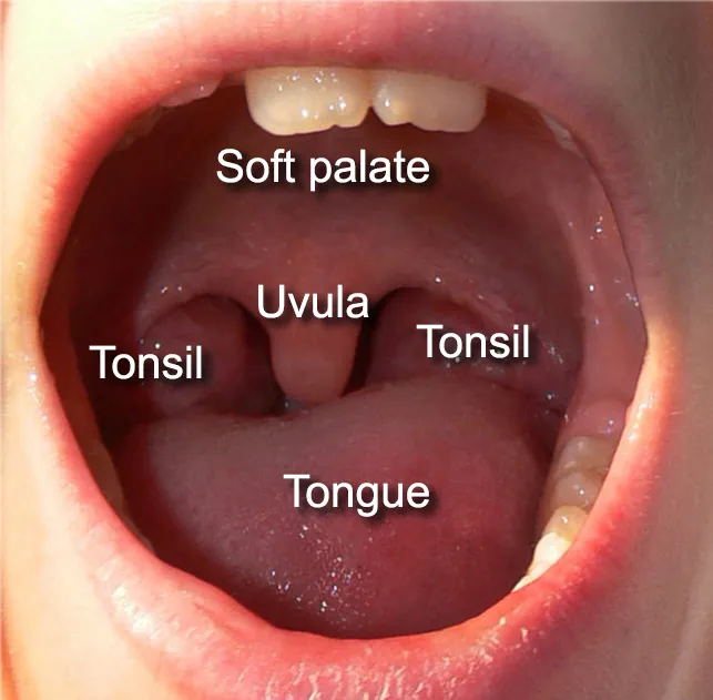 Open mouth with the soft palate, uvula, tonsils and tongue labeled
